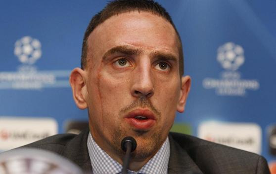 franck-ribery franck-ribery